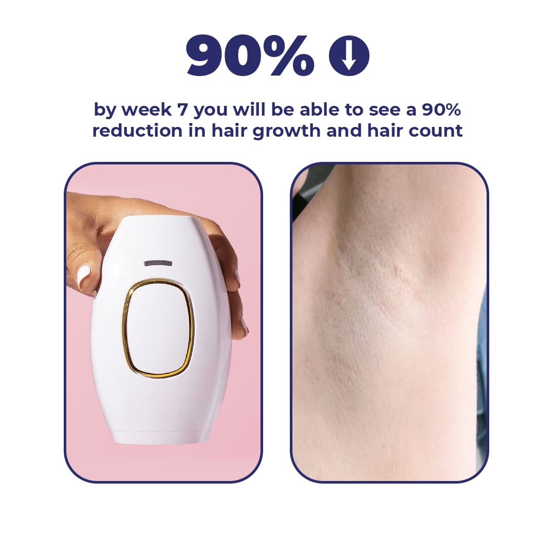 sheneeds' Pocket IPL Laser Device