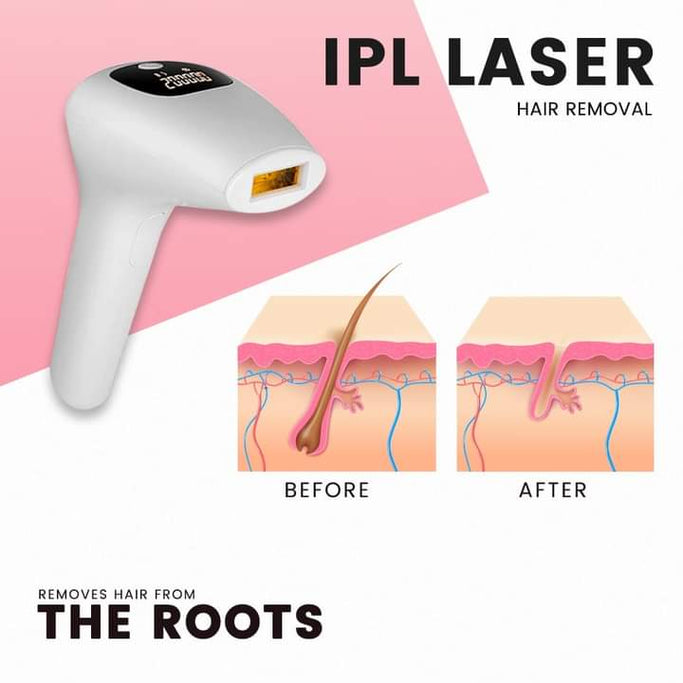Sheneeds' IPL Pro Hair Remover